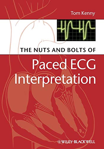 The Nuts and Bolts of Paced ECG Interpretation (Nuts and Bolts Series (Replaced by 5113))